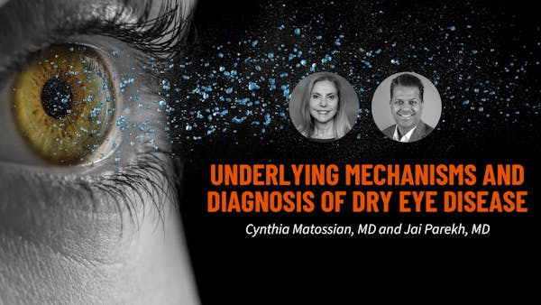 Underlying Mechanisms and Diagnosis of Dry Eye Disease thumbnail