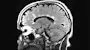 MS The Latest: imaging and testing