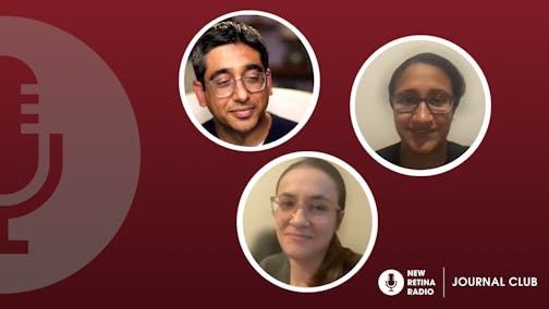 Is Software on Home OCT as Good as Human Graders?