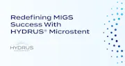 Peer-to-Peer Hydrus Microstent
