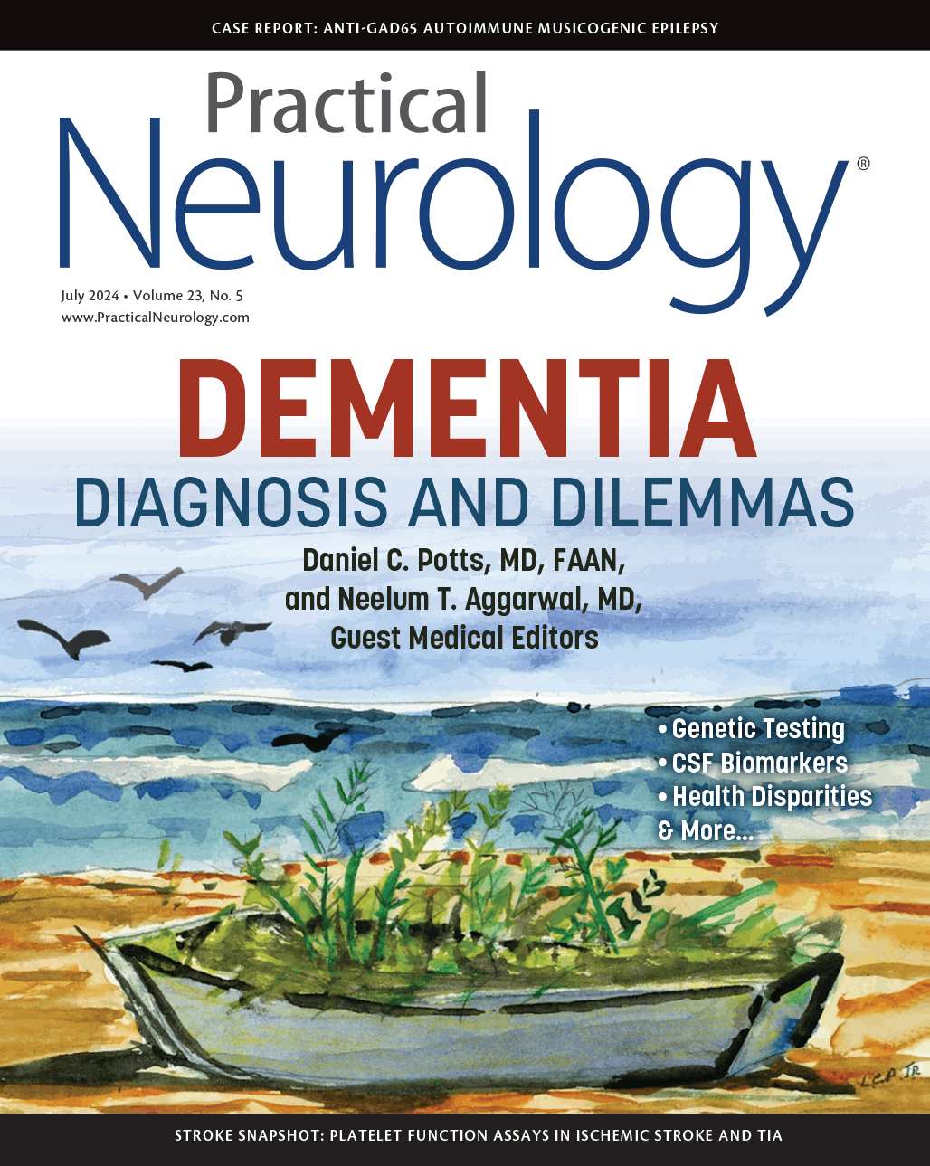 Novel Sigma-1 Receptor Therapy Slowed Clinical Progression in Alzheimer ...