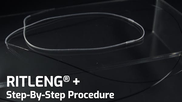 RITLENG®: Stey-by-Step Procedure thumbnail