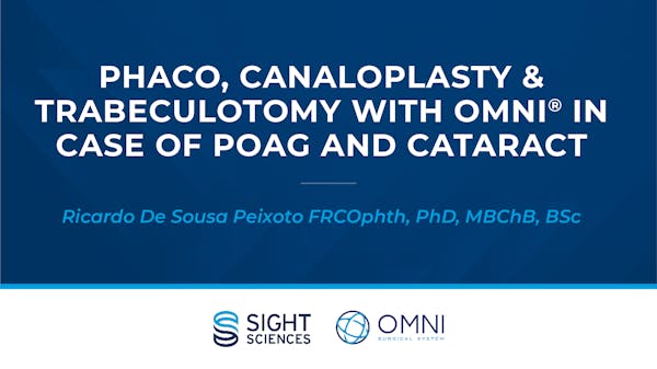 Phaco, Canaloplasty & Trabeculotomy With OMNI in Case of POAG and Cataract thumbnail