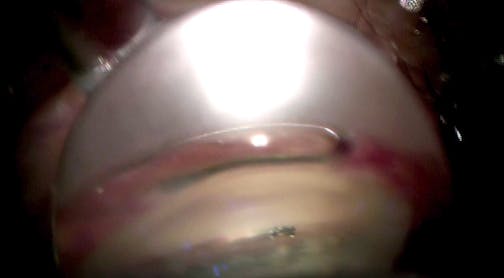 Hydrus Teaching Case