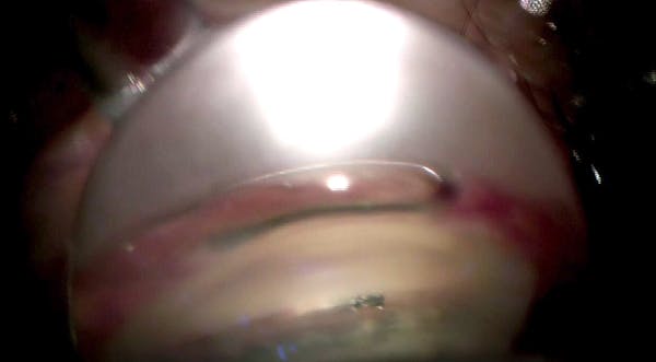 Hydrus Teaching Case thumbnail