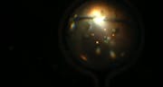 Secondary Rhegmatogenous Retinal Detachment From Acute Retinal Necrosis