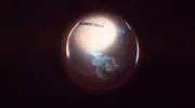 Vitreomacular Traction Resulting in Macular Hole and Retinal Detachment