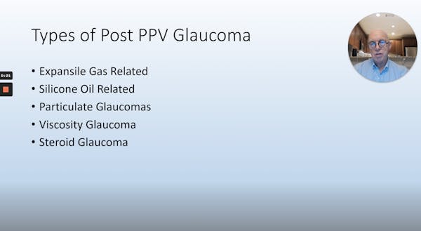 Post-Vitrectomy Glaucoma thumbnail
