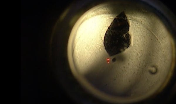 SimulEYE YAG Capsulotomy thumbnail