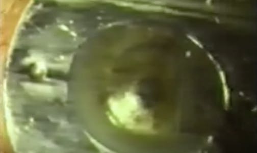 First Lasik Procedure Ever