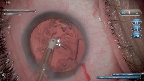 Resident 101: Cortical Considerations
