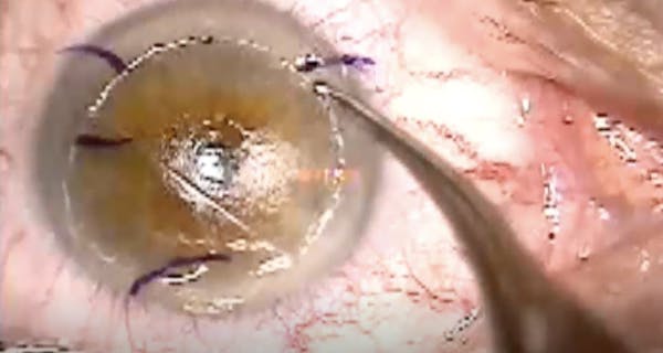 Raindrop Removal Technique thumbnail
