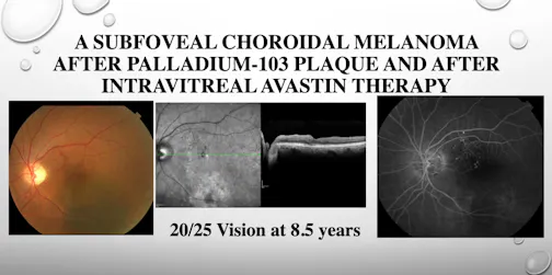Intravitreal Injection Methods