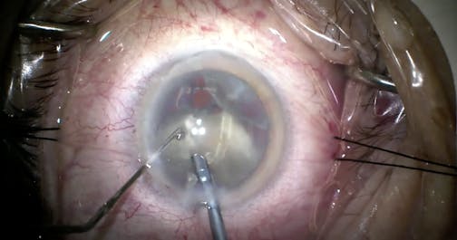 Using Technology to Make a Challenging Case Routine