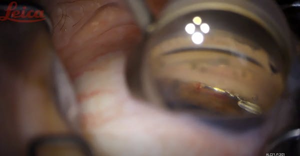 Low Lying Hydrus thumbnail