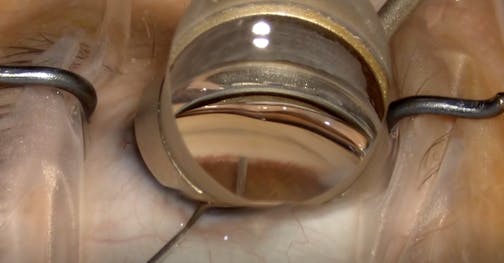 Internal Fluid Wave