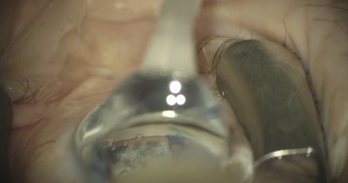 Outflow Renovation With Streamline - Eyetube