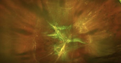 Illuminated Infusion