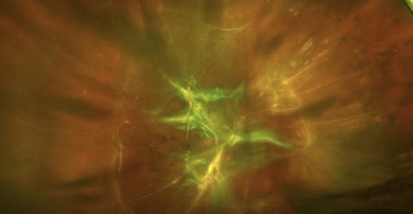 Illuminated Infusion thumbnail