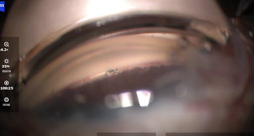 Verify Positioning of the Hydrus