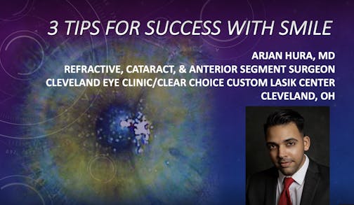 3 Tips for Success with SMILE