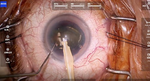 Quatera Flip and Chip