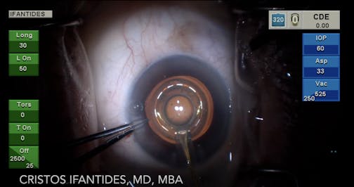 Routine Zepto Case