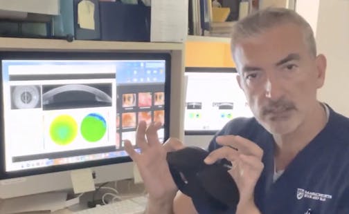 DIY Sleep Mask/Shield for Keratoconus