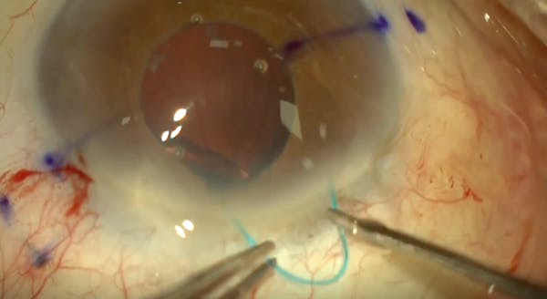 Flattened Flange thumbnail