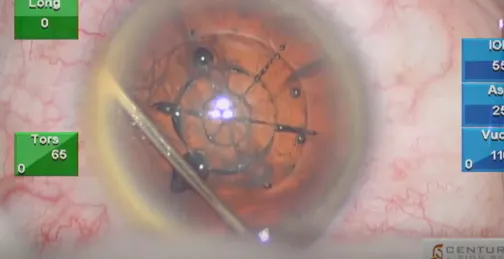 Nuclear Fragmentation in a Medium-to-Hard Nucleus