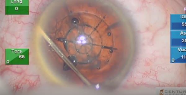 Nuclear Fragmentation in a Medium-to-Hard Nucleus thumbnail