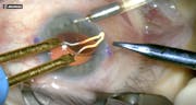 Piercing Flange Technique With Haptic Externalization