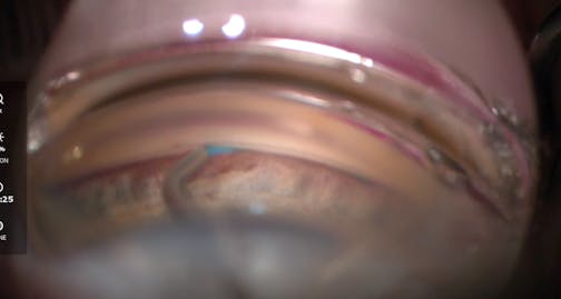 Ergo-Series of the OMNI Surgical System