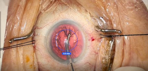 Flip and Chip Control