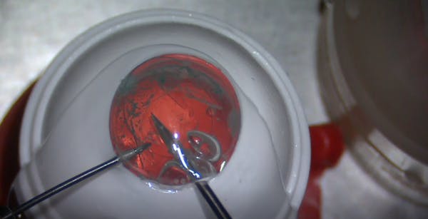 LAL Explantation With SimulEye thumbnail