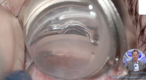 Hydrus: Techniques for Real-World Practice (Part 1)