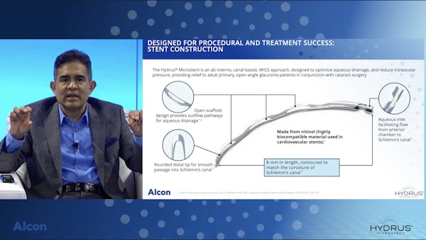 Understanding Hydrus Microstent's Trimodal MoA thumbnail