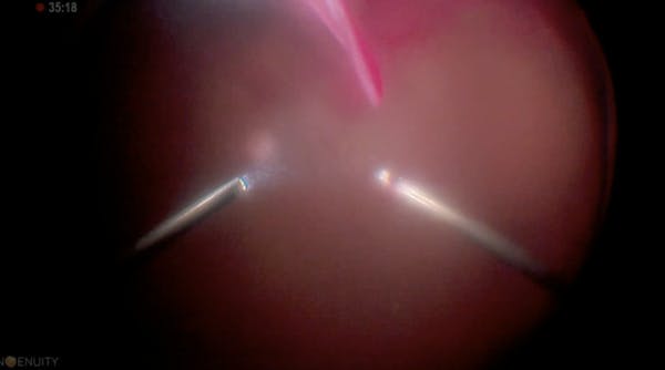 Dr. Alan Franklin - NGENUITY 1.4 Overview thumbnail