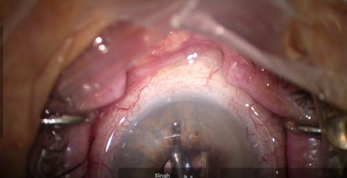 Standalone Streamline