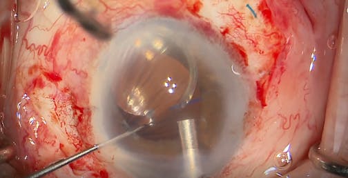 Yamane Haptic Curing