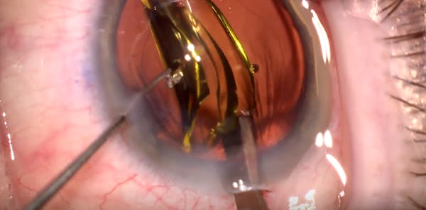 A Variety of Explant Techniques thumbnail