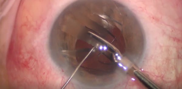 Cut-and-Conquer Technique thumbnail