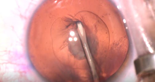 Decisions, Decisions