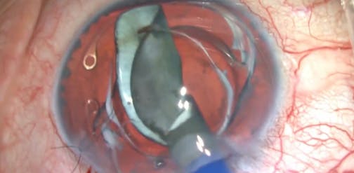 Locked Chamber Mystery