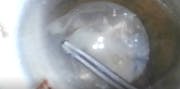 Morgagnian Cataract