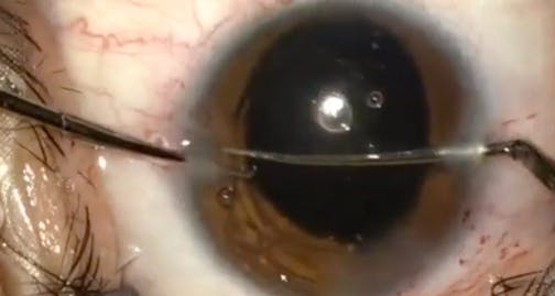 Blue Vitreous