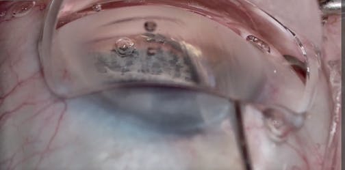 A Good View Is Worth a Thousand Stitches