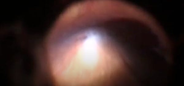 Testing a Cryotherapy Machine thumbnail