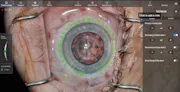 Keep Your Eyes on the “Road” With NGENUITY