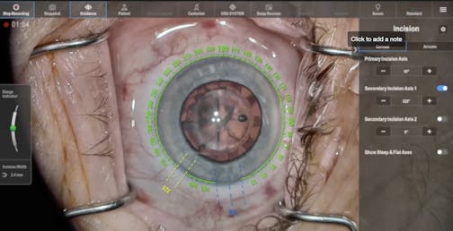 Keep Your Eyes on the “Road” With NGENUITY